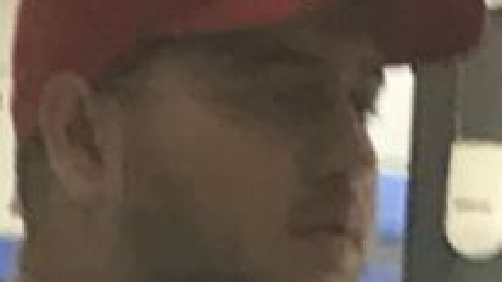 Image of subject wearing a cap