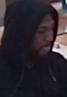 Subject 1 side profile